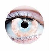 Verre de contact - Peste